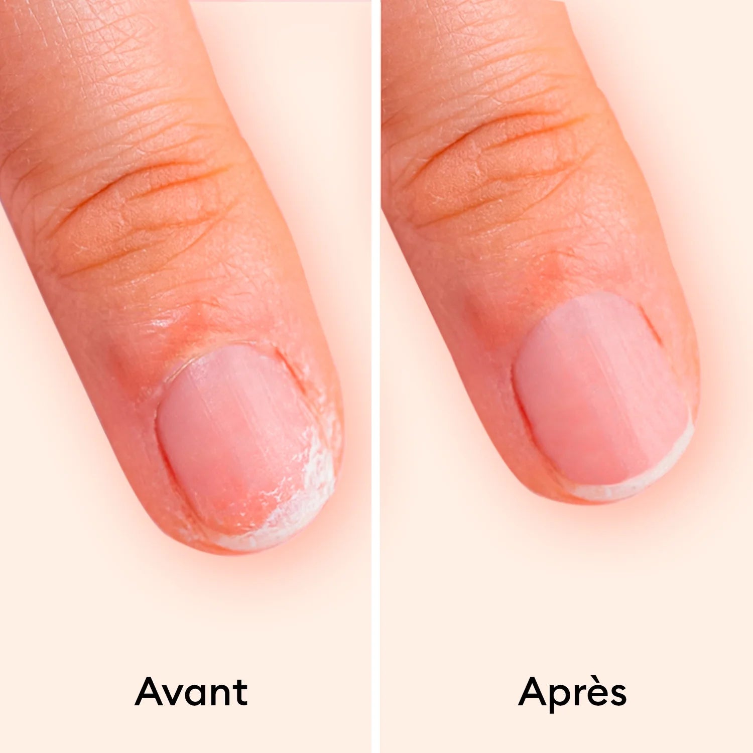 Duo Day & Night - Set de soin des ongles
